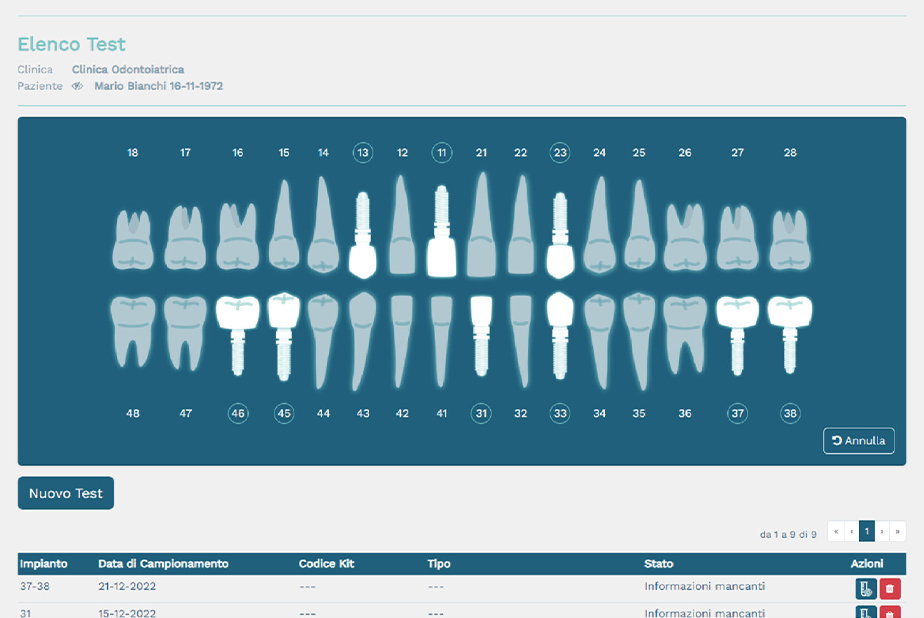 grafica del test