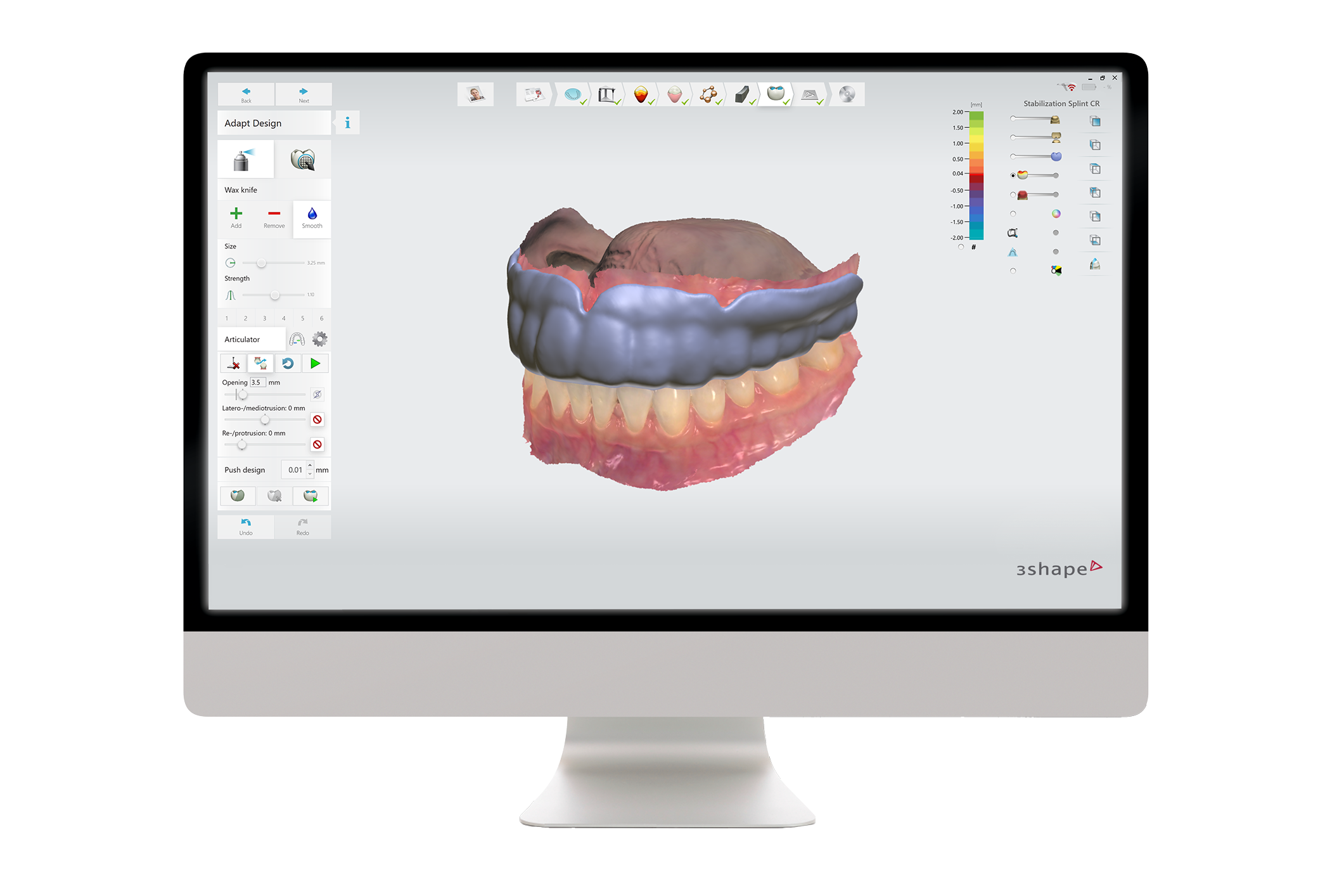 Splint Studio