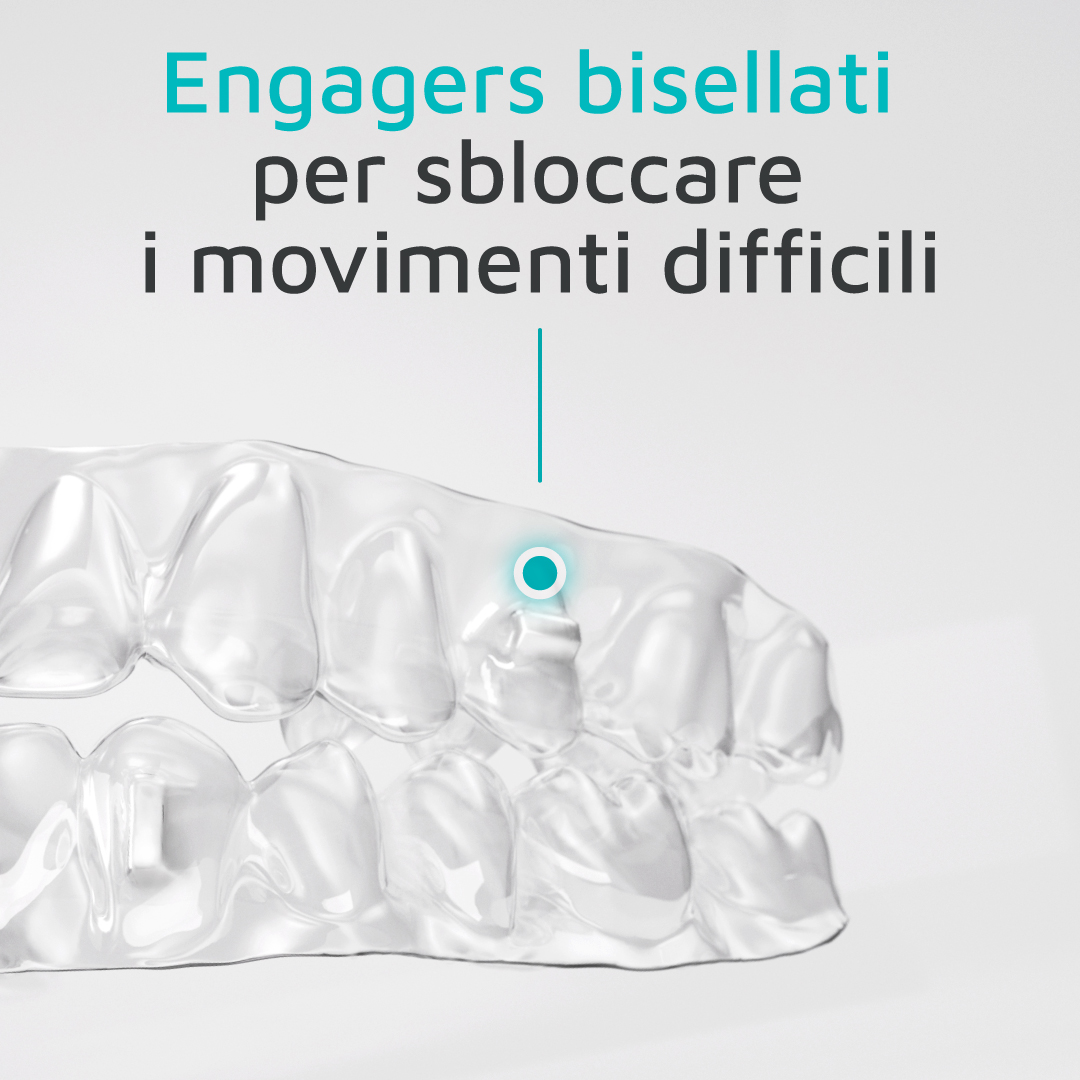 engagers