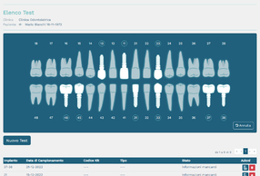 grafica del test